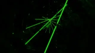 Lasers